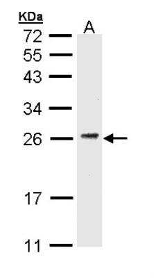 Western Blot: CD3 gamma Antibody [NBP1-31250]
