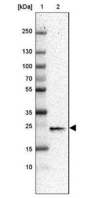 Western Blot: CD3 gamma Antibody [NBP2-32636]