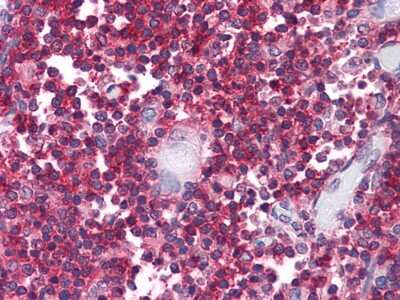 Immunohistochemistry-Paraffin: CD3 zeta Antibody (4B10) - BSA Free [NBP1-42561]
