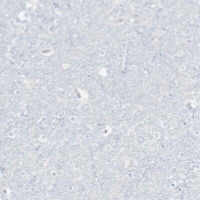 Immunohistochemistry-Paraffin: CD3 zeta Antibody [NBP1-85750]