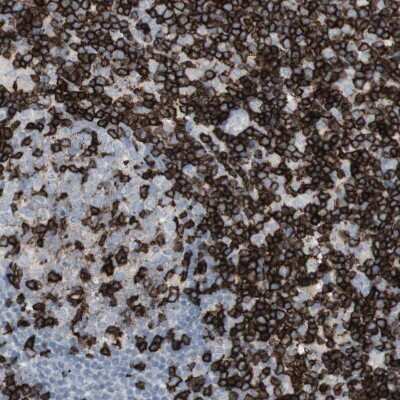 Immunohistochemistry-Paraffin: CD3 zeta Antibody [NBP1-85750]