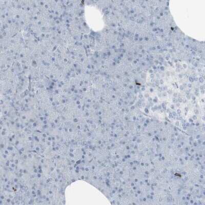 Immunohistochemistry-Paraffin: CD3 zeta Antibody [NBP1-85750]