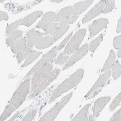 Immunohistochemistry-Paraffin: CD3 zeta Antibody [NBP1-85750]