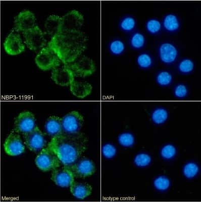 Immunocytochemistry/ Immunofluorescence: CD30 Ligand/TNFSF8 Antibody (RM153) - Chimeric - Azide and BSA Free [NBP3-11991]