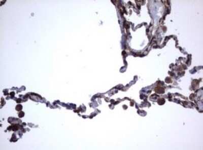 Immunohistochemistry: CD30/TNFRSF8 Antibody (OTI1C6) [NBP2-46157]