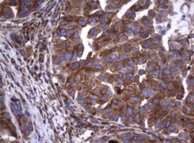 Immunohistochemistry: CD30/TNFRSF8 Antibody (OTI1C6) [NBP2-46157]