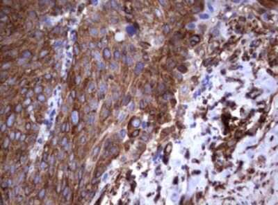 Immunohistochemistry: CD30/TNFRSF8 Antibody (OTI1C6) [NBP2-46157]