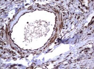 Immunohistochemistry: CD30/TNFRSF8 Antibody (OTI1C6) [NBP2-46157]