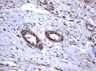 Immunohistochemistry: CD30/TNFRSF8 Antibody (OTI1C6) [NBP2-46157]