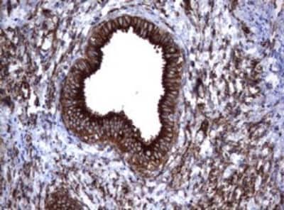 Immunohistochemistry: CD30/TNFRSF8 Antibody (OTI1C6) [NBP2-46157]