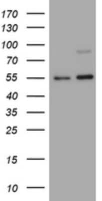 Western Blot: CD30/TNFRSF8 Antibody (OTI1C6) [NBP2-46157]