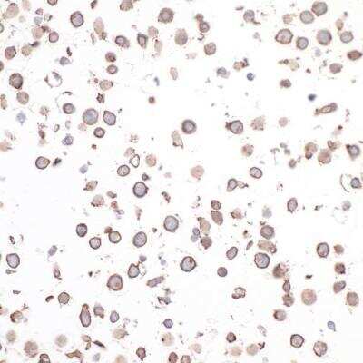 Immunocytochemistry/ Immunofluorescence: CD30/TNFRSF8 Antibody (BLR055F) [NBP2-76365]