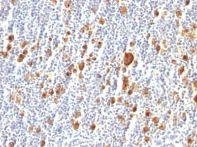 Immunohistochemistry-Paraffin: CD30/TNFRSF8 Antibody (Ber-H2) [NBP2-44559]