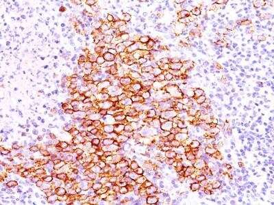 Immunohistochemistry-Paraffin: CD30/TNFRSF8 Antibody (CD30/412) [NBP2-29425]