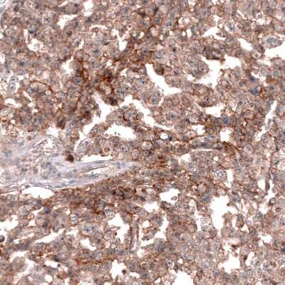 Immunohistochemistry-Paraffin: CD30/TNFRSF8 Antibody (CL12632) [NBP3-18541]