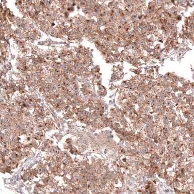 Immunohistochemistry-Paraffin: CD30/TNFRSF8 Antibody (CL12632) [NBP3-18541]