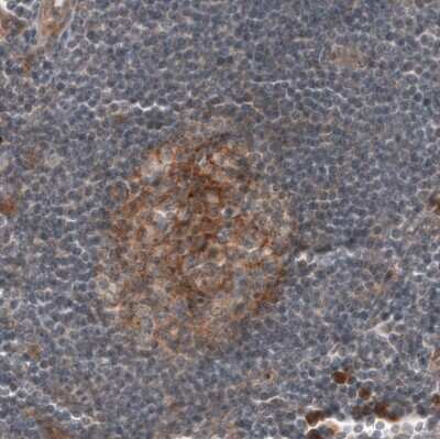 Immunohistochemistry-Paraffin: CD30/TNFRSF8 Antibody (CL12632) [NBP3-18541]