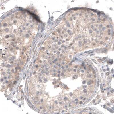 Immunohistochemistry-Paraffin: CD30/TNFRSF8 Antibody (CL12632) [NBP3-18541]