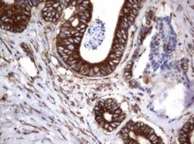 Immunohistochemistry: CD30/TNFRSF8 Antibody (OTI1C6) - Azide and BSA Free [NBP2-70374]