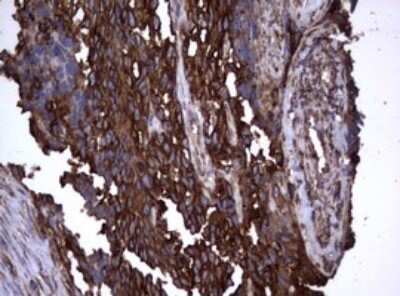 Immunohistochemistry: CD30/TNFRSF8 Antibody (OTI1C6) - Azide and BSA Free [NBP2-70374]