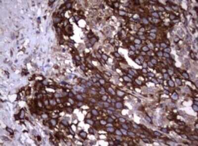 Immunohistochemistry: CD30/TNFRSF8 Antibody (OTI1C6) - Azide and BSA Free [NBP2-70374]