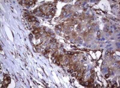 Immunohistochemistry: CD30/TNFRSF8 Antibody (OTI1C6) - Azide and BSA Free [NBP2-70374]