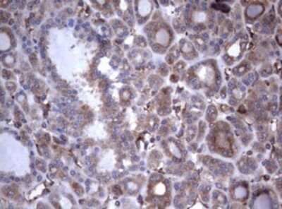 Immunohistochemistry: CD30/TNFRSF8 Antibody (OTI1C6) - Azide and BSA Free [NBP2-70374]