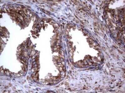 Immunohistochemistry: CD30/TNFRSF8 Antibody (OTI1C6) - Azide and BSA Free [NBP2-70374]