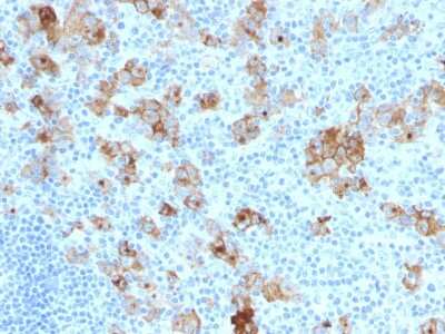 Immunohistochemistry-Paraffin: CD30/TNFRSF8 Antibody (SPM121) [NBP2-44560]