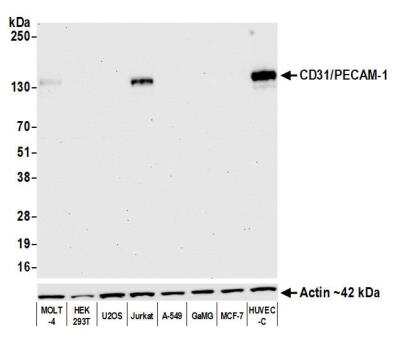 Western Blot: CD31/PECAM-1 Antibody (BLR127H) [NBP3-14710]
