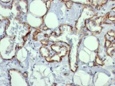 Immunohistochemistry-Paraffin: CD31/PECAM-1 Antibody (C31.10) - IHC-Prediluted [NBP2-48330]