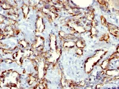 Immunohistochemistry-Paraffin: CD31/PECAM-1 Antibody (C31.3 + C31.7 + C31.10) - Azide and BSA Free [NBP2-47785]
