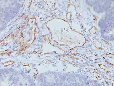 Immunohistochemistry-Paraffin: CD31/PECAM-1 Antibody (C31.3 + C31.7 + C31.10) - Azide and BSA Free [NBP2-47785]