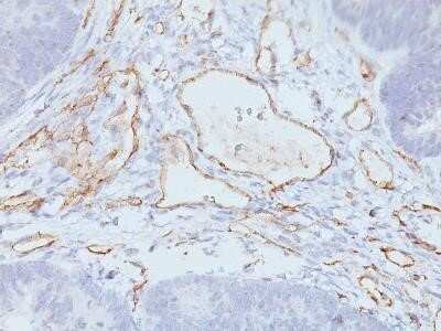 Immunohistochemistry-Paraffin: CD31/PECAM-1 Antibody (C31.3 + JC/70A) - Azide and BSA Free [NBP2-34578]