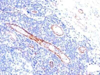 Immunohistochemistry-Paraffin: CD31/PECAM-1 Antibody (C31.3) - IHC-Prediluted [NBP2-44334]