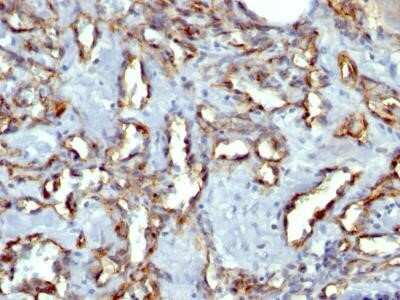 Immunohistochemistry-Paraffin: CD31/PECAM-1 Antibody (C31.7) [NBP2-15188]