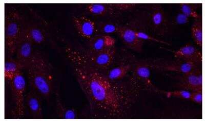 Immunocytochemistry/Immunofluorescence Detection of CD31/PECAM-1 in Porcine SC Cells