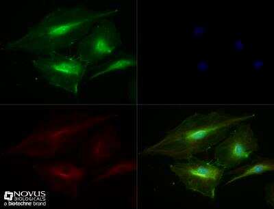 Immunocytochemistry/ Immunofluorescence: CD31/PECAM-1 Antibody - BSA Free [NBP1-71663]