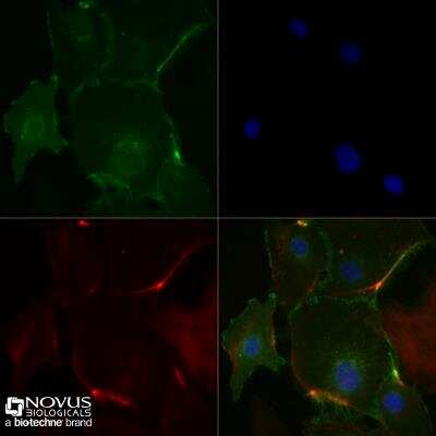 Immunocytochemistry/Immunofluorescence Staining of CD31/PECAM-1 in HUVEC Cells