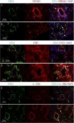 Immunohistological Analysis of CD31/PECAM-1 in Frozen KC and Control Bladder Sections