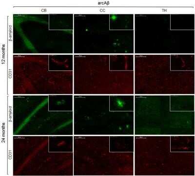 Immunohistochemistry: CD31/PECAM-1 Antibody (MEC 7.46) - Azide and BSA Free [NBP2-80639]