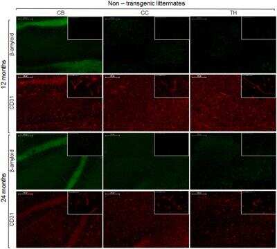 Immunohistochemistry: CD31/PECAM-1 Antibody (MEC 7.46) [NB100-1642]