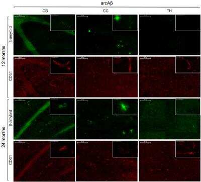 Immunohistochemistry: CD31/PECAM-1 Antibody (MEC 7.46) [NB100-1642]