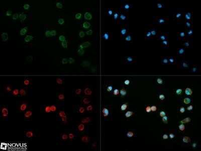 Immunocytochemistry/ Immunofluorescence: CD31/PECAM-1 Antibody (MEC13.3) - Azide and BSA Free [NBP2-80640]