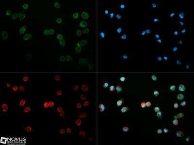 Immunocytochemistry/ Immunofluorescence: CD31/PECAM-1 Antibody (MEC13.3) - BSA Free [NB600-1475]