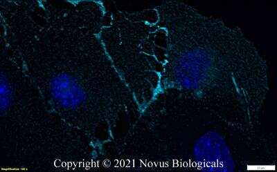 Immunocytochemistry/ Immunofluorescence: CD31/PECAM-1 Antibody (MEC13.3) - BSA Free [NB600-1475]