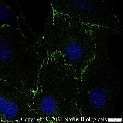 Immunocytochemistry/ Immunofluorescence: CD31/PECAM-1 Antibody (MEC13.3) - BSA Free [NB600-1475]