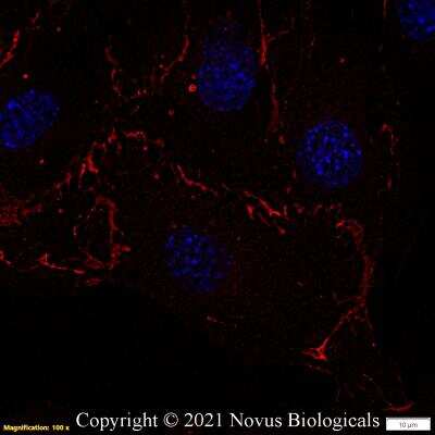 Immunocytochemistry/ Immunofluorescence: CD31/PECAM-1 Antibody (MEC13.3) - BSA Free [NB600-1475]