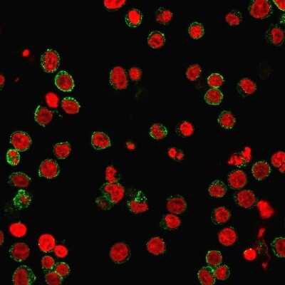 Immunocytochemistry/ Immunofluorescence: CD31/PECAM-1 Antibody (SPM532) [NBP2-32818]