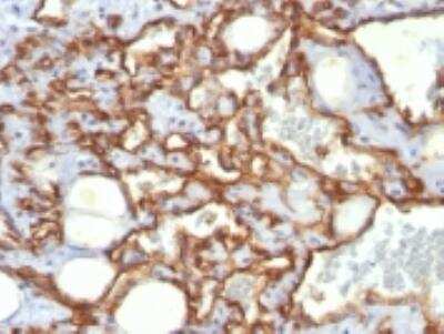 Immunohistochemistry-Paraffin: CD31/PECAM-1 Antibody (SPM532) [NBP2-32818]